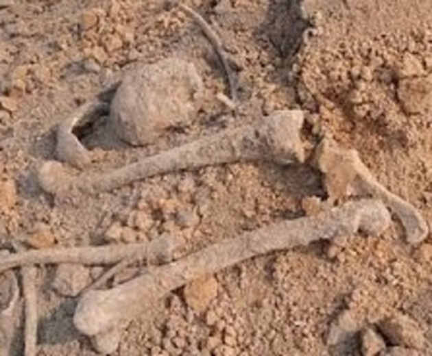 В ереванской больнице обнаружено множество человеческих останков