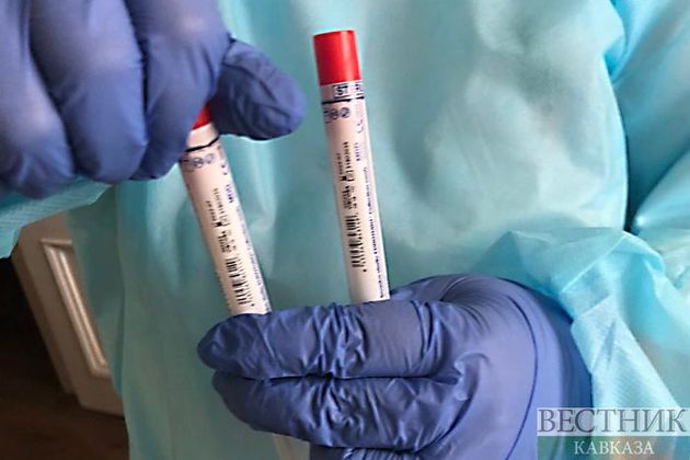 30 тысяч тест-систем для диагностики коронавируса получила Киргизия от России