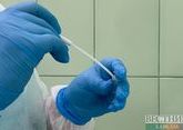 ВОЗ признала эталонной российскую тест-систему определения коронавируса