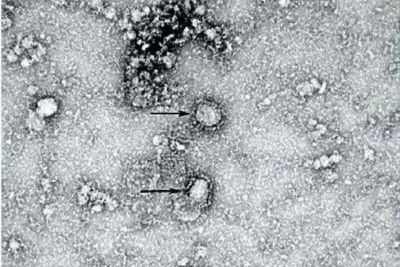 В Иране зафиксировали еще три заражения коронавирусом